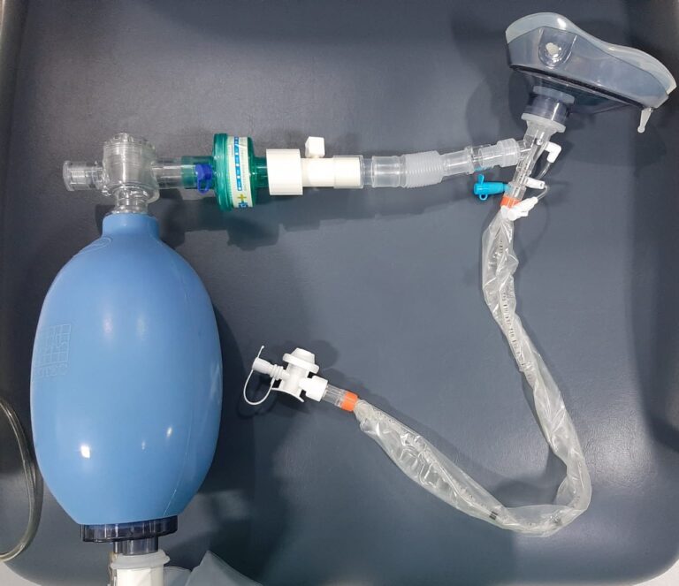 UNIFACIG produz peças para ventiladores pulmonares da UTI COVID-19