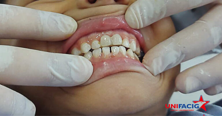 Curso de Odontologia do UNIFACIG prioriza o investimento em responsabilidade social