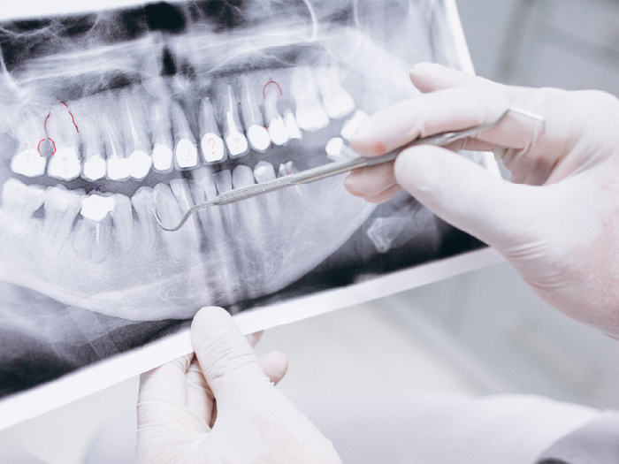 Aperfeiçoamento em Endodontia