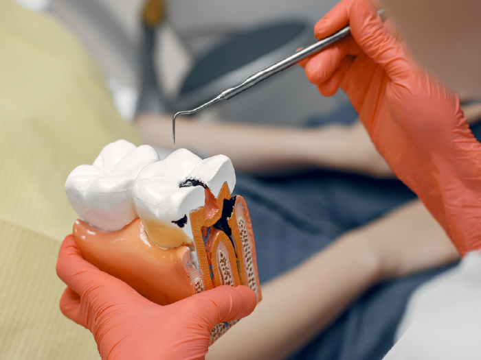 Especialização em Endodontia